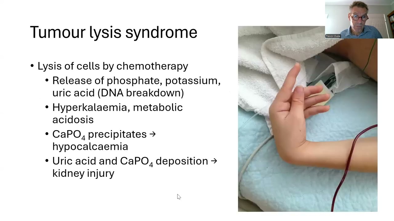 2025 10 Oncology emergencies in children