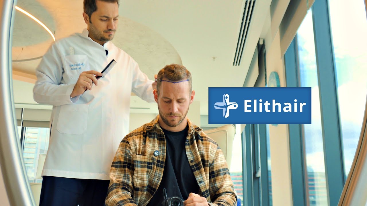 Meine Haartransplantation bei Dr. Balwi - @Elithair