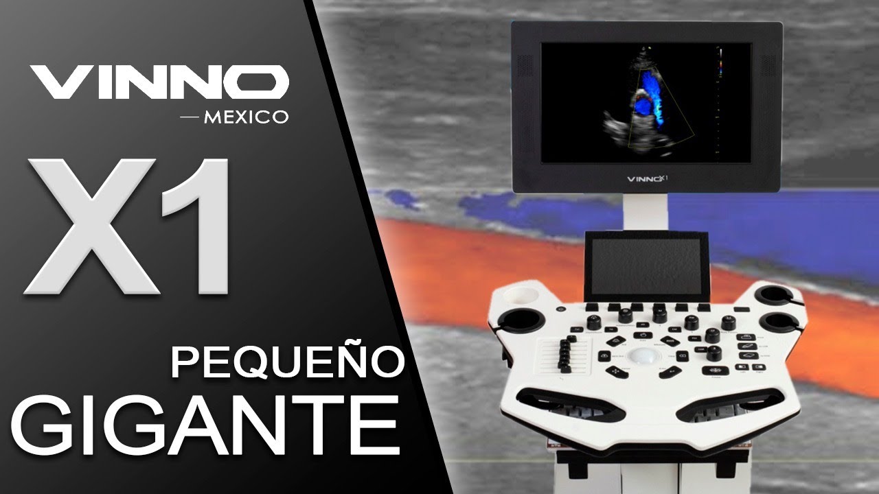Ultrasonido Mexico Vinno X1 / Estudios 4D
