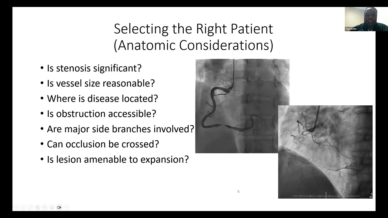STEMI Webinar Series : Principles of PCI