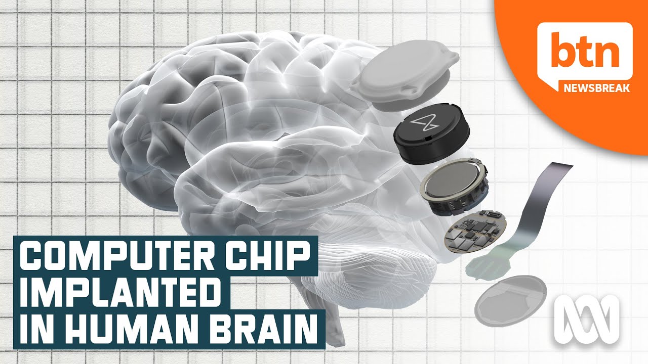 Neuralink's Computer Chip Brain Implant