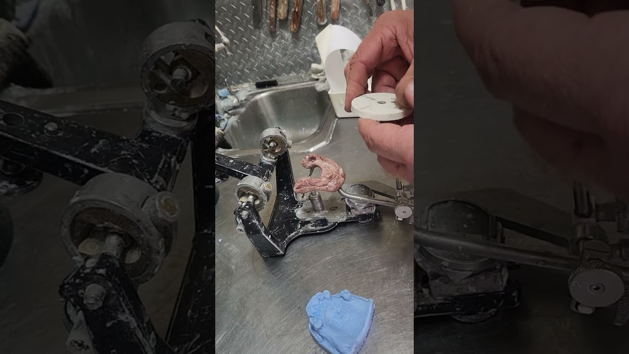 Setting up a Hanau articulator with a facebow transfer