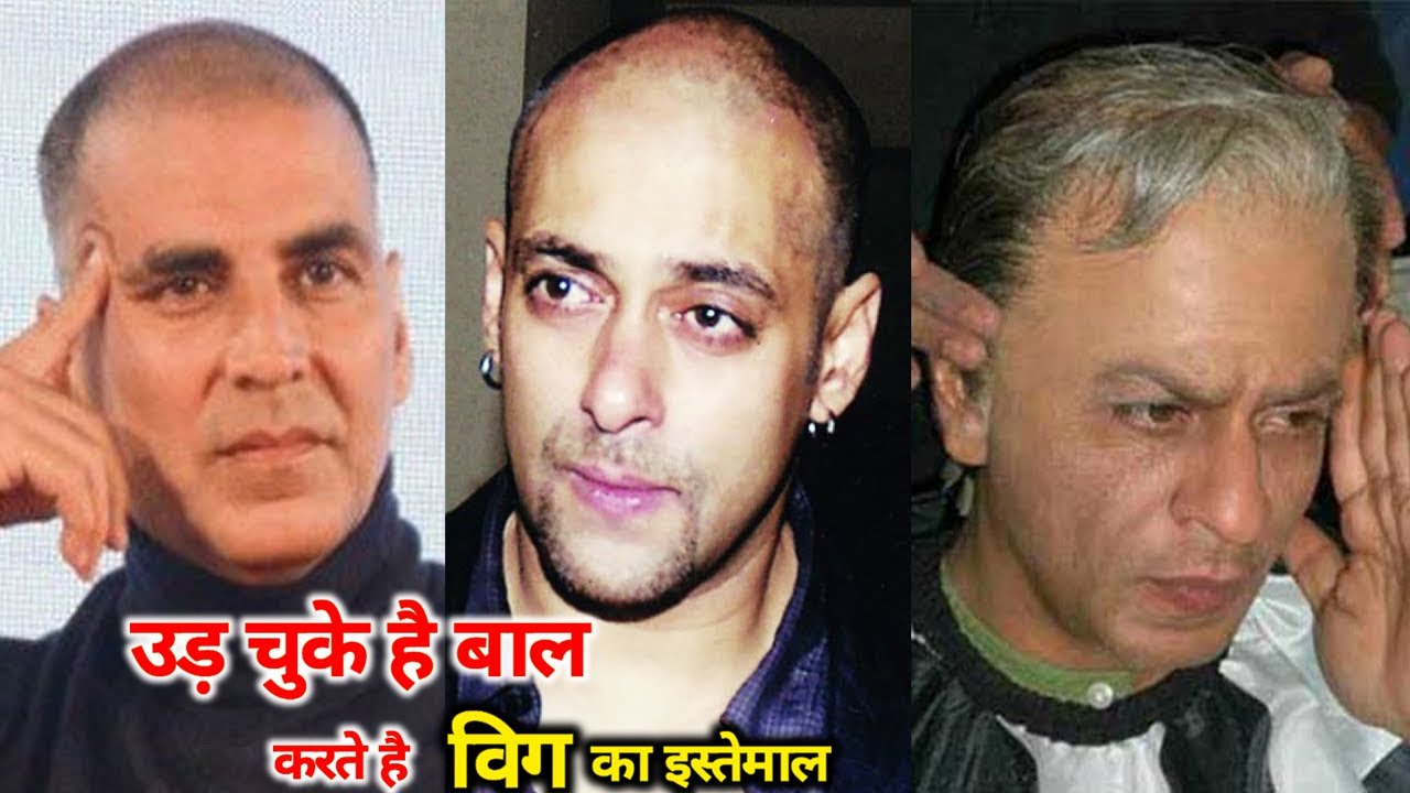गंजापन छुपाने के लिए नकली बाल लगाते है Bollywood के ये 10 Superstar | 10 Actors hair transplant, Wig