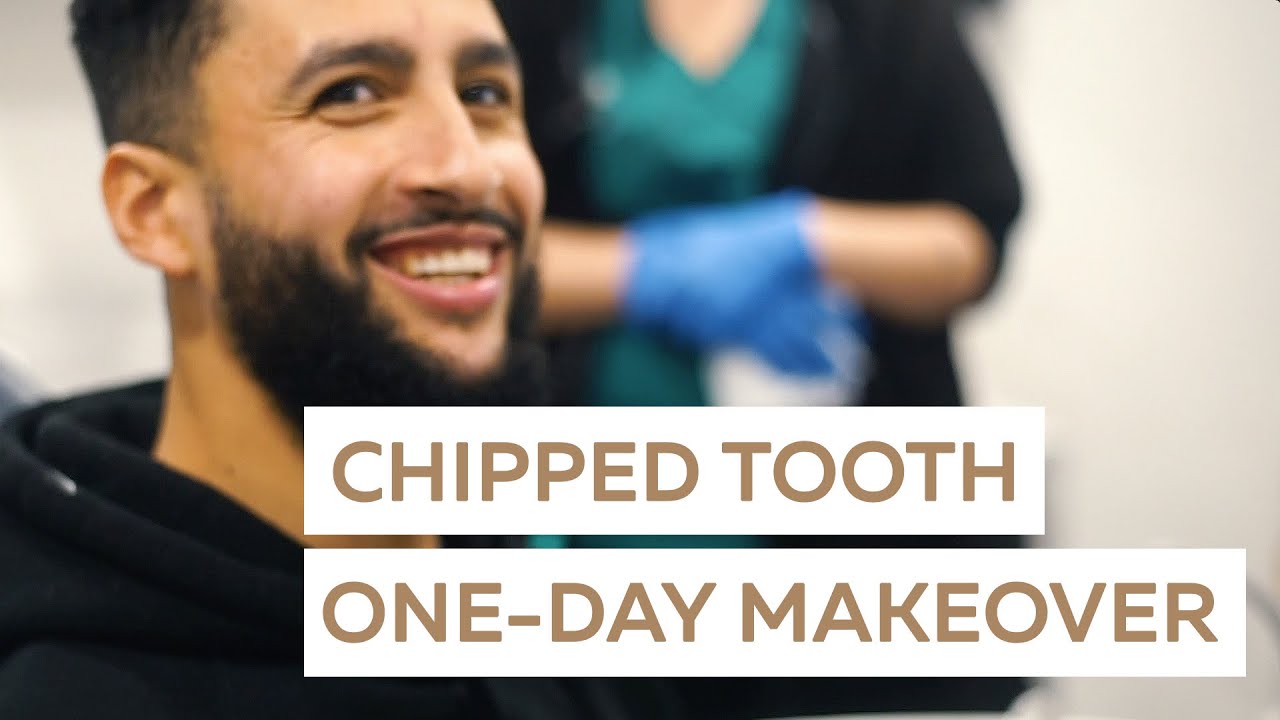 Chipped Tooth One-Day Smile Makeover | Nate's Story
