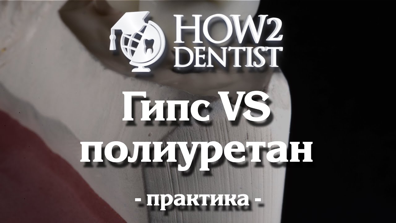 Как выбрать материал для модели? / How to Dentist