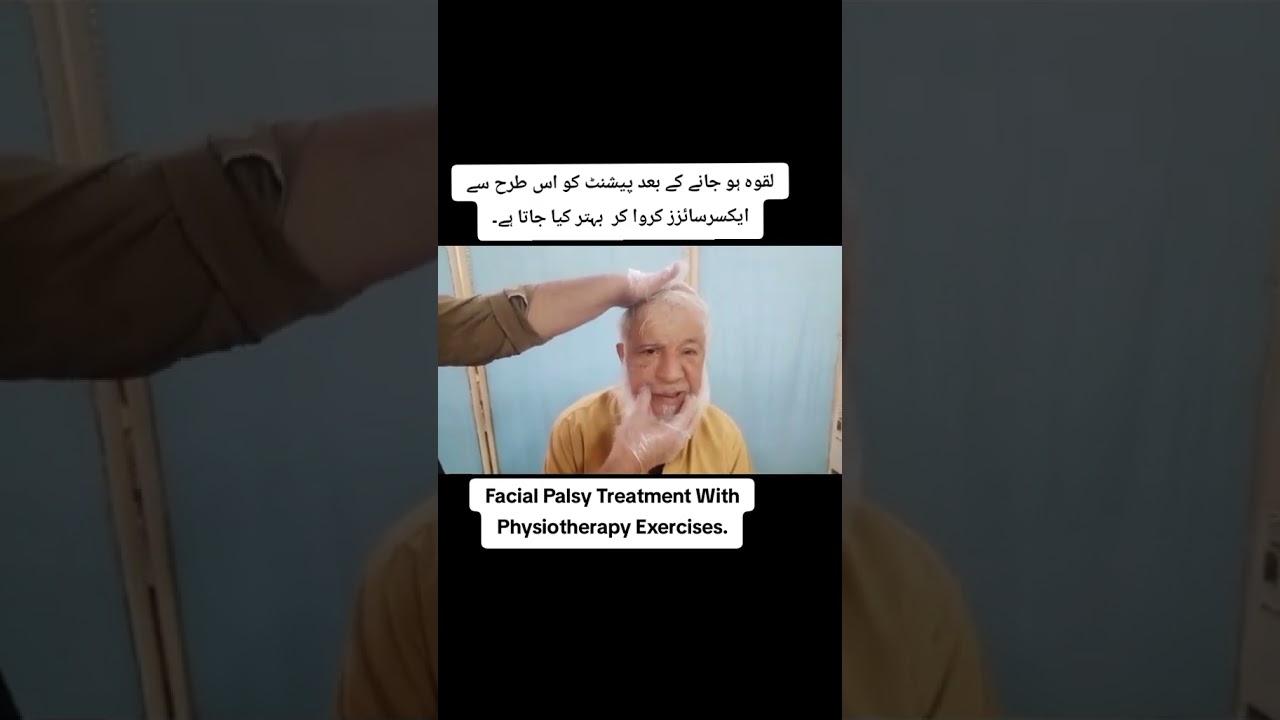 Best Exercises for Bell&rsquo;s Palsy || Facial Paralysis#Physiotherapy #Rehab#Fitness#Laqwa#Health #Viral