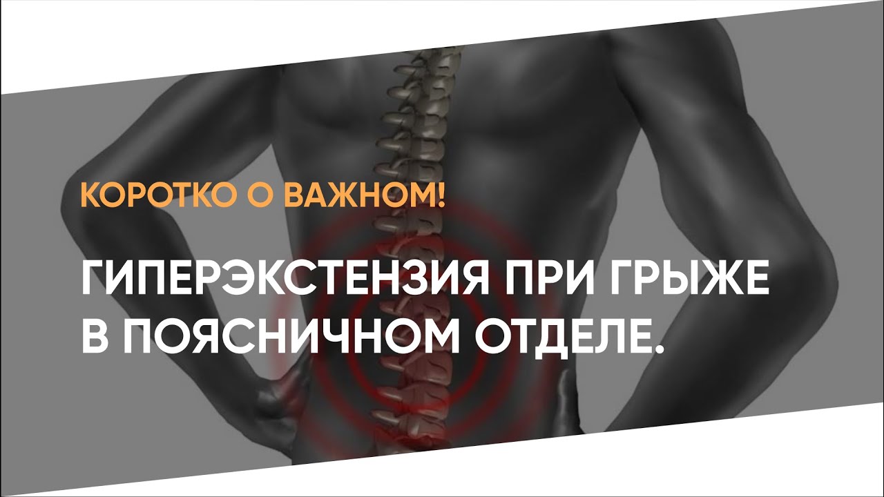 Коротко о важном! Гиперэкстензия при грыже в поясничном отделе!