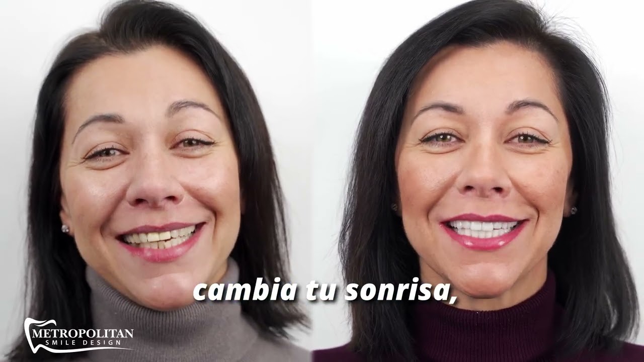 Diseño de Sonrisa Natural con Especialistas en Broward County