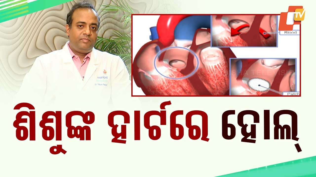 Stay Fit: Know How to Detect Hole in Children's Hearts