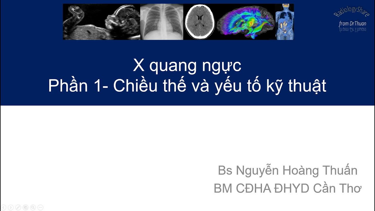 X quang ngực_ Phan1 Chieu The Va Yeu To Ky Thuat