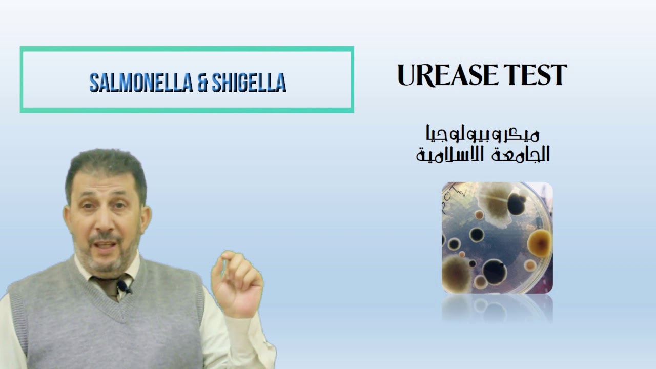 Urease