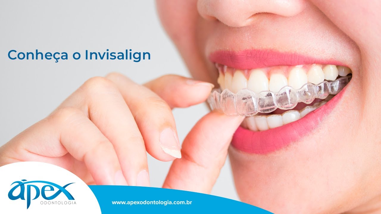 Conheça o Invisalign Alinhador Transparente | Ápex Odontologia