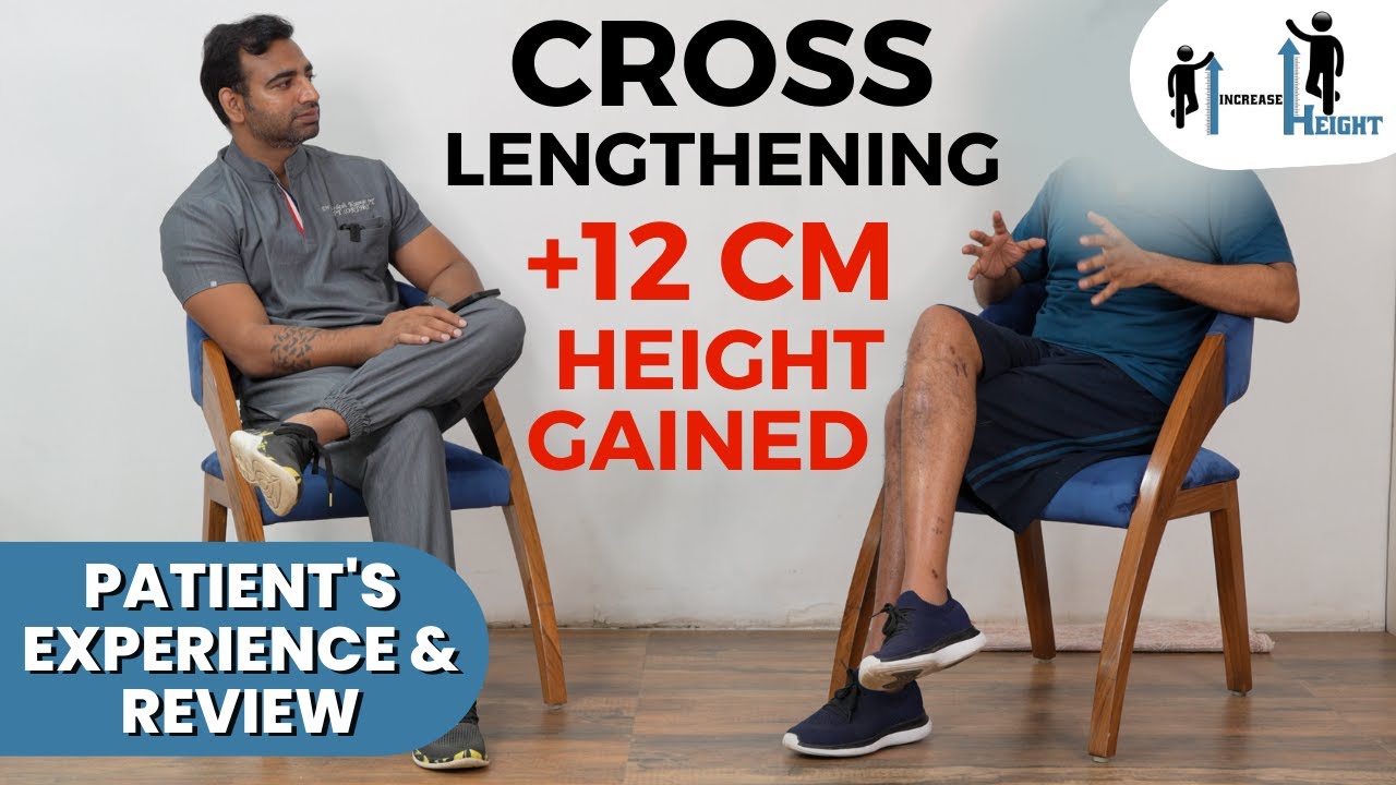 +12 cm Height Gained #Cross Limb Lengthening Patient Experience, #limblengthening in Gurgaon, India