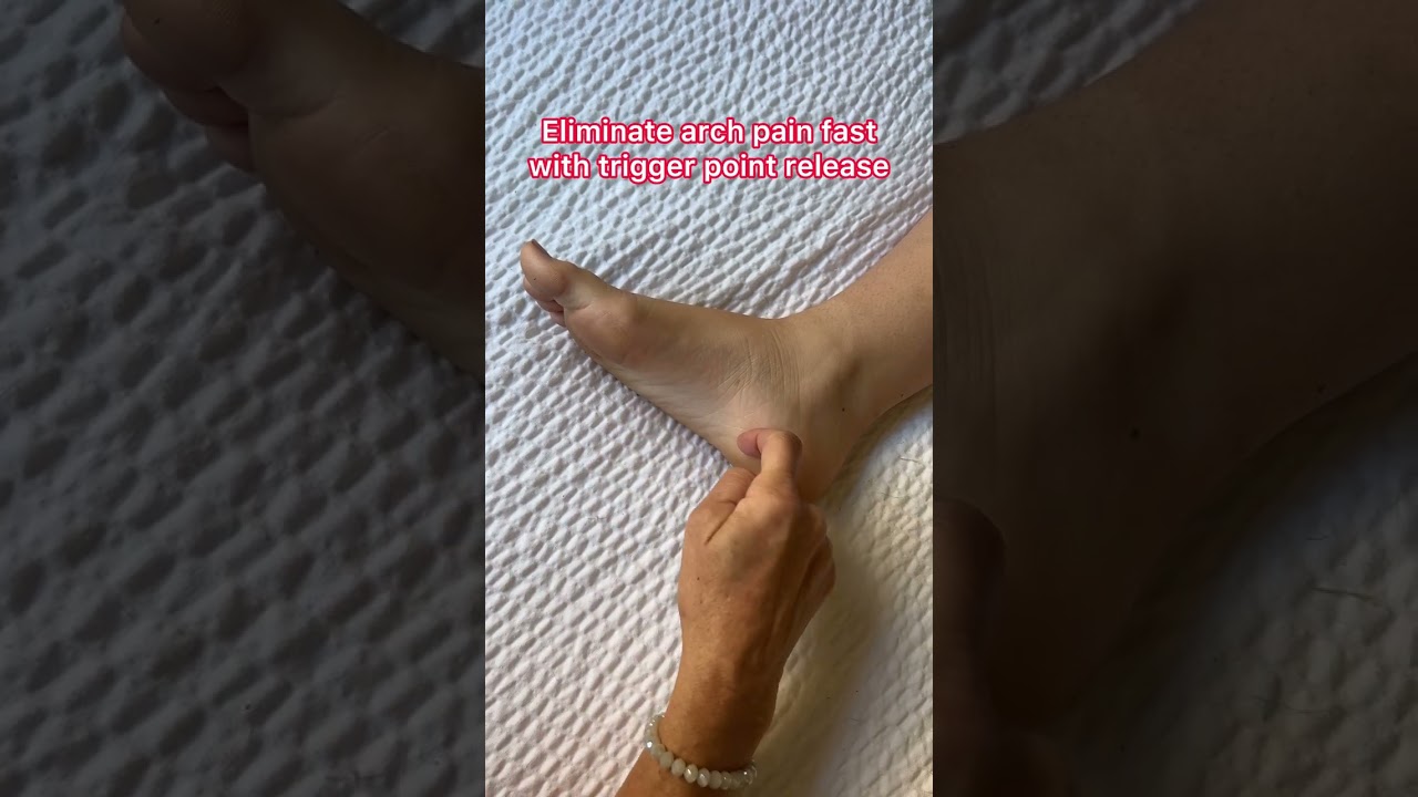 Eliminate arch pain fast with trigger point release