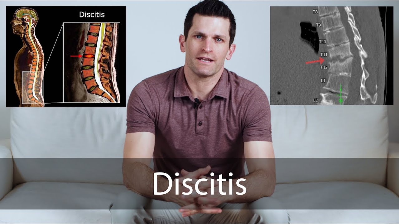Discitis // everything you need to know