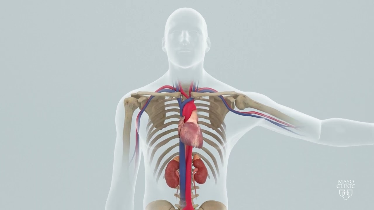 Intra Aortic Balloon Pump (IABP)