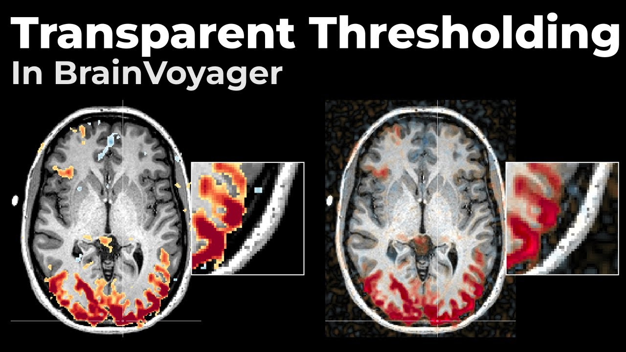 BrainVoyager Tips and Tricks - Transparent Thresholding