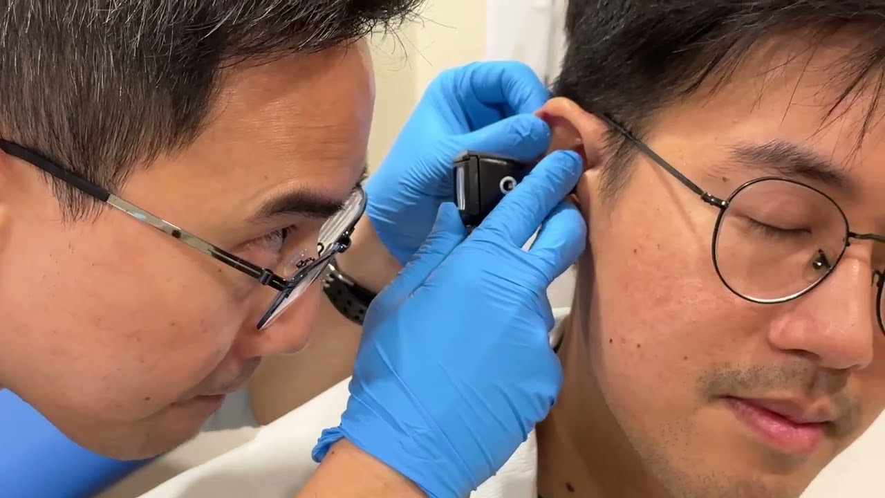 Ear Syringing Procedure
