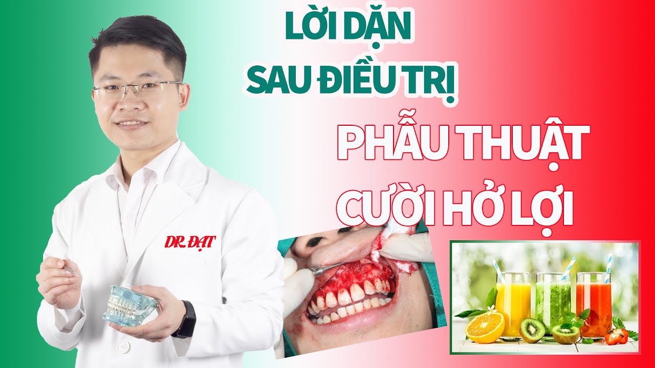 Lời dặn sau khi chữa cười hở lợi