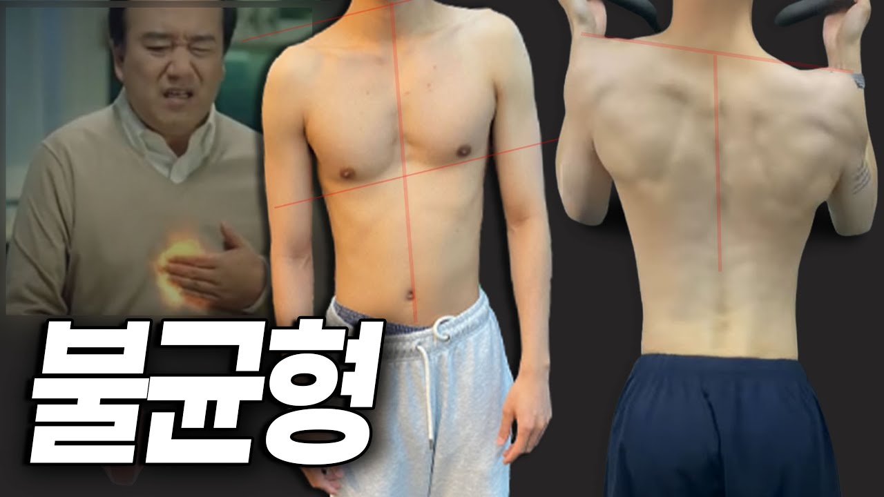 n년 동안 돌고 돌아 찾은 비대칭 해결책
