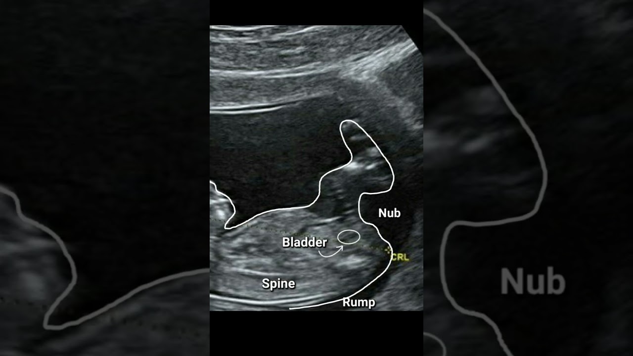 Объяснение теории Nub: название приложения Gender Reveal (nubx)