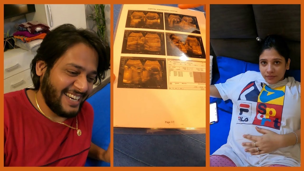 Humare Baby👶 ki First Picture❤️🥺 || Papa bhi chale gye!!