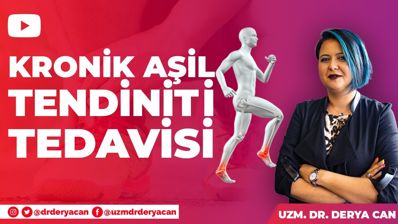 Kronik Aşil Tendiniti tedavisi - Proloterapi tedavisi