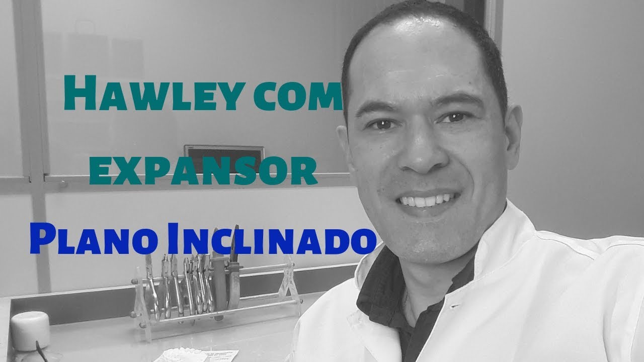 Como fazer o HAWLEY COM EXPANSOR - PASSO A PASSO