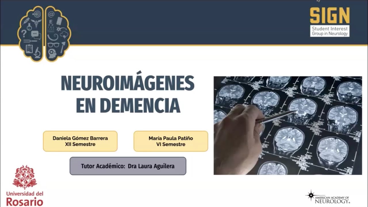 Neuroimágenes en demencia