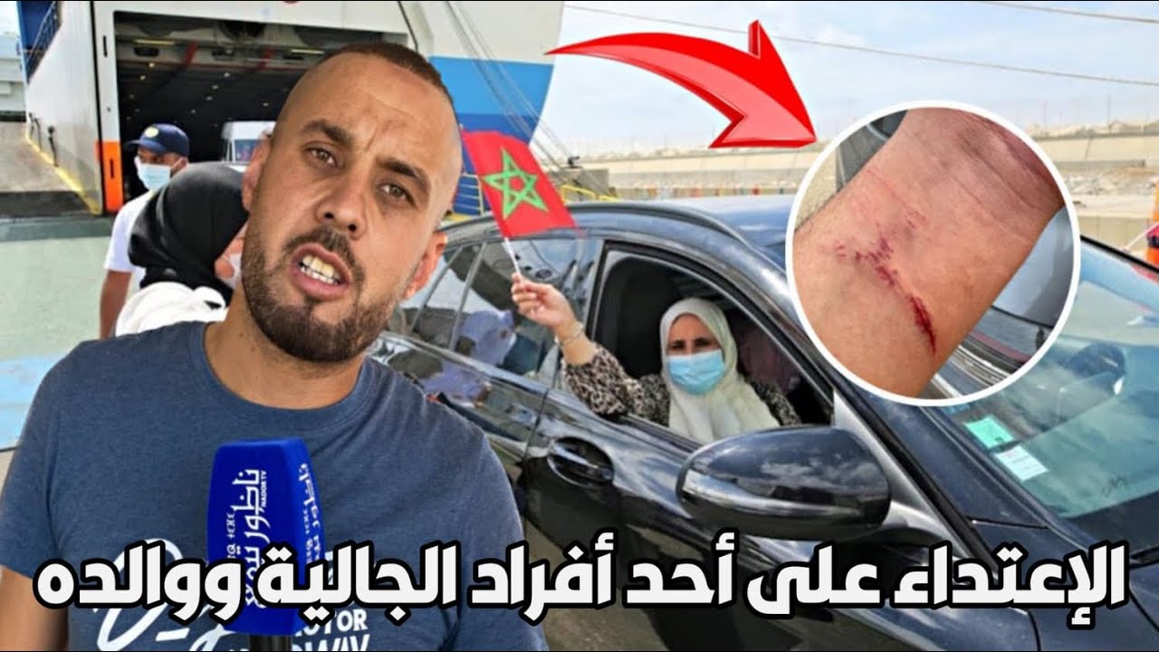 خطير : الإعتداء على أحد أبناء الجالية ووالده 
