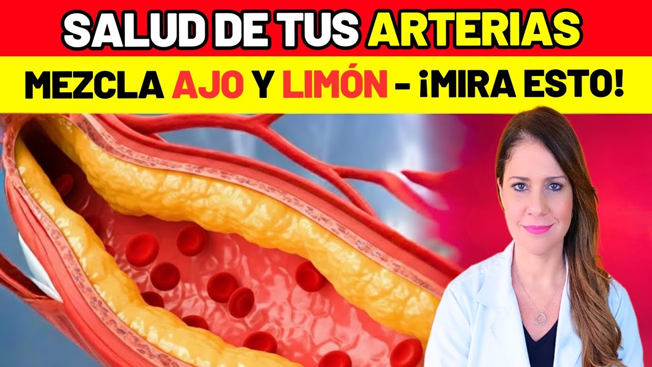 Mezcla LIMÓN y AJO y TE SORPRENDERÁ (ASÍ se hace) - SALUD DE TUS ARTERIAS