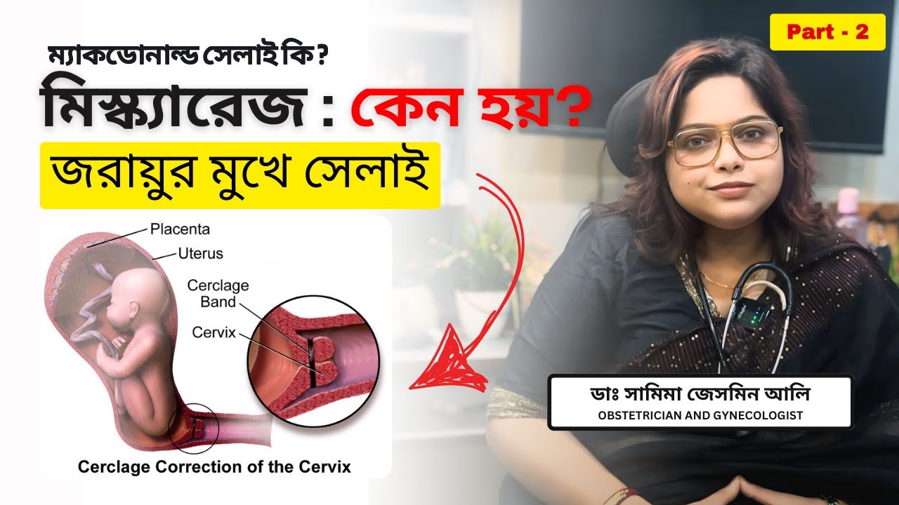 বারবার গর্ভপাত ? McDonald stitch কি ? Miscarriage symptoms in Bangla | Cervical incompetence