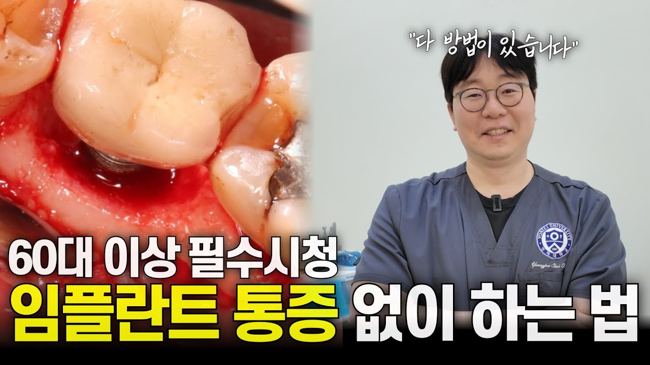 아플 이유가 없습니다. 임플란트 통증 없이 하는 방법 | 임플란트, 임플란트 비용