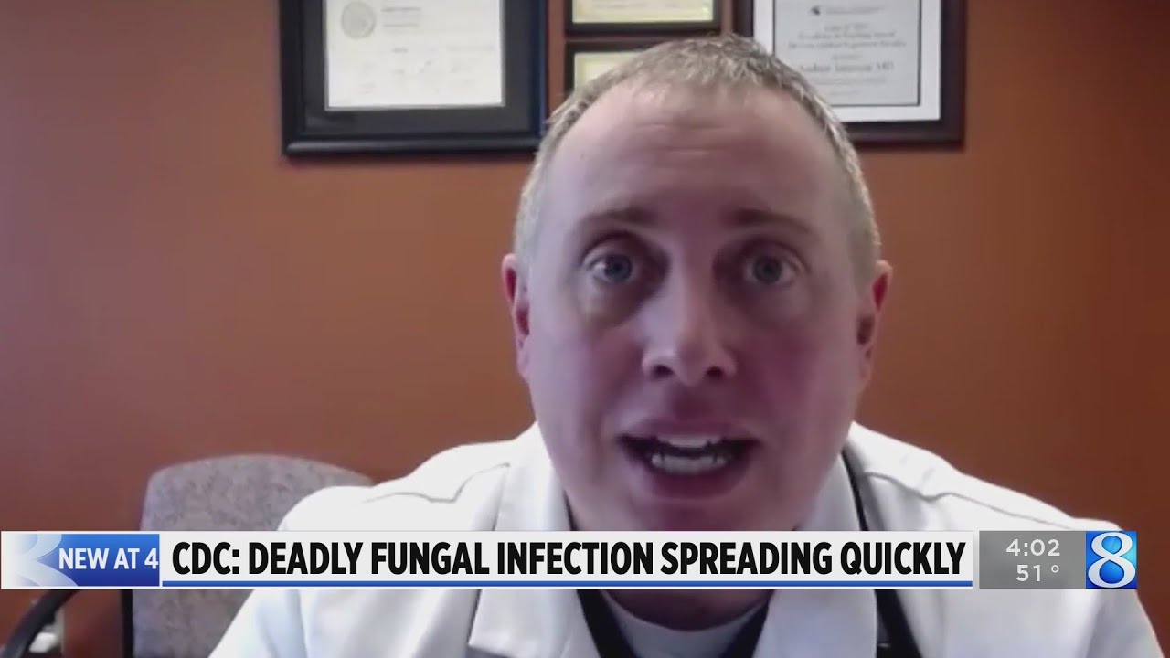 West Michigan hospitals keep eye out for fungal infection