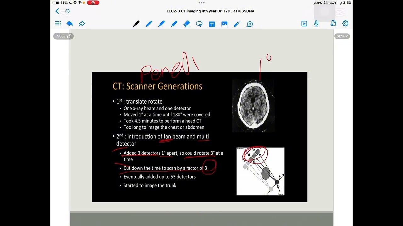 CT 2 
