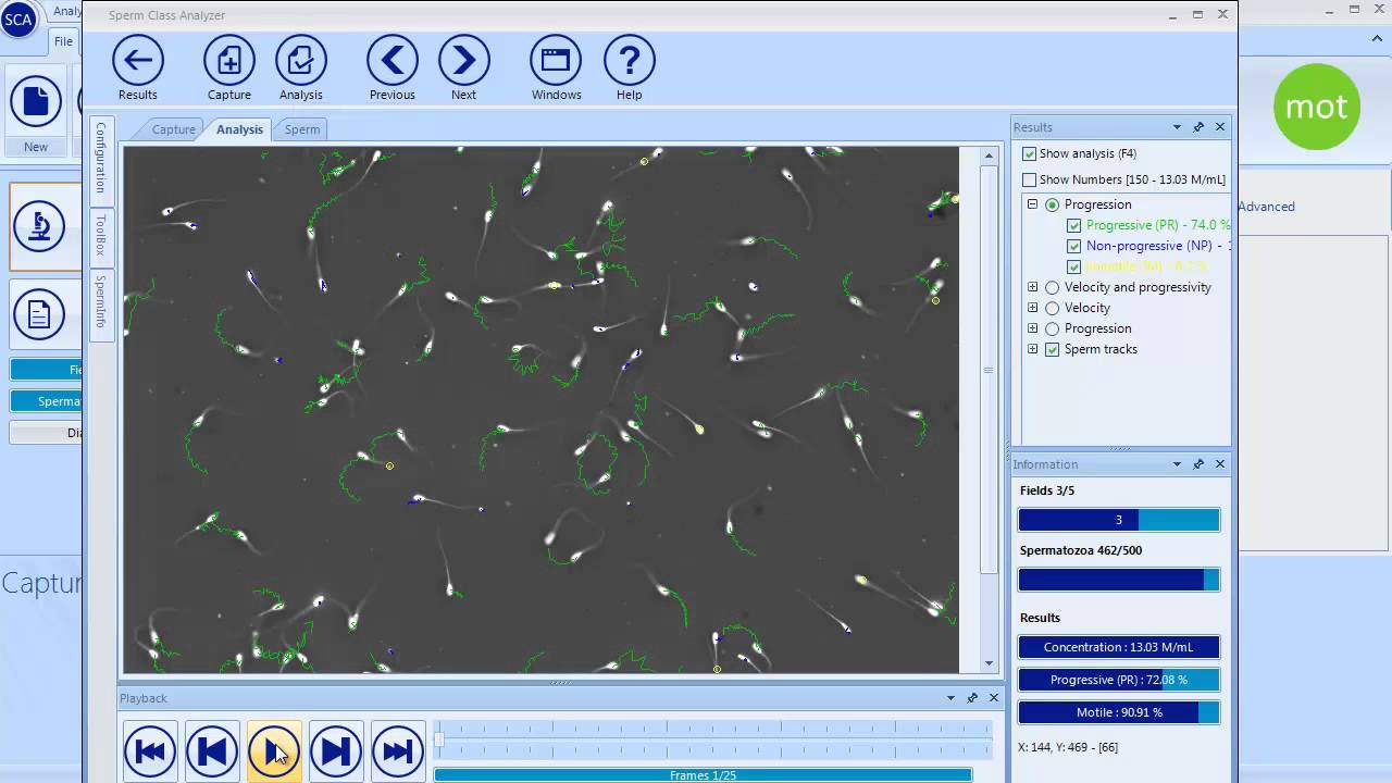 SCA Motility and concentration - CASA System SCA Evolution (Veterinary Edition)