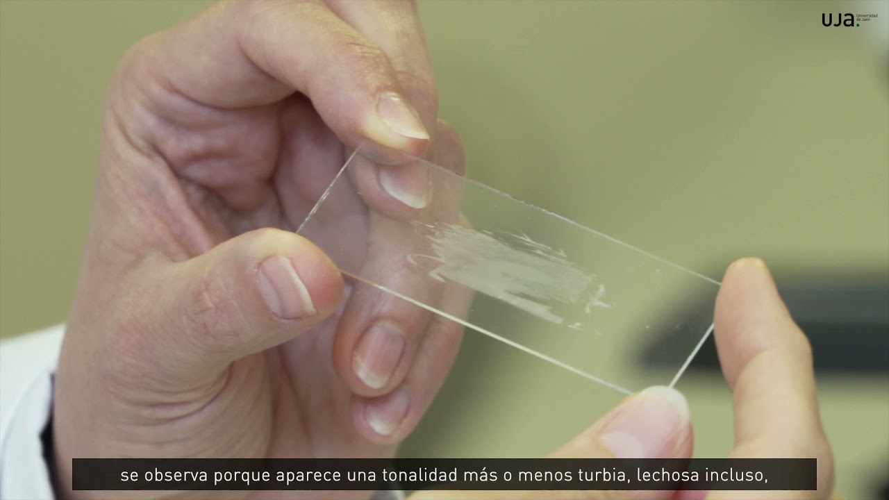 Tinción y observación de levaduras - Universidad de Jaén