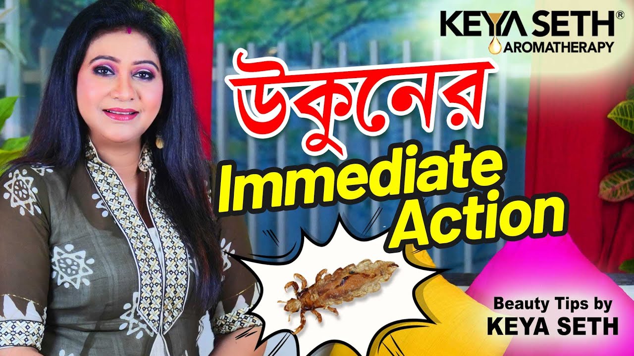 উকুনের immediate action| উকুনের দ্রুত সমাধান| Tips by Keya Seth