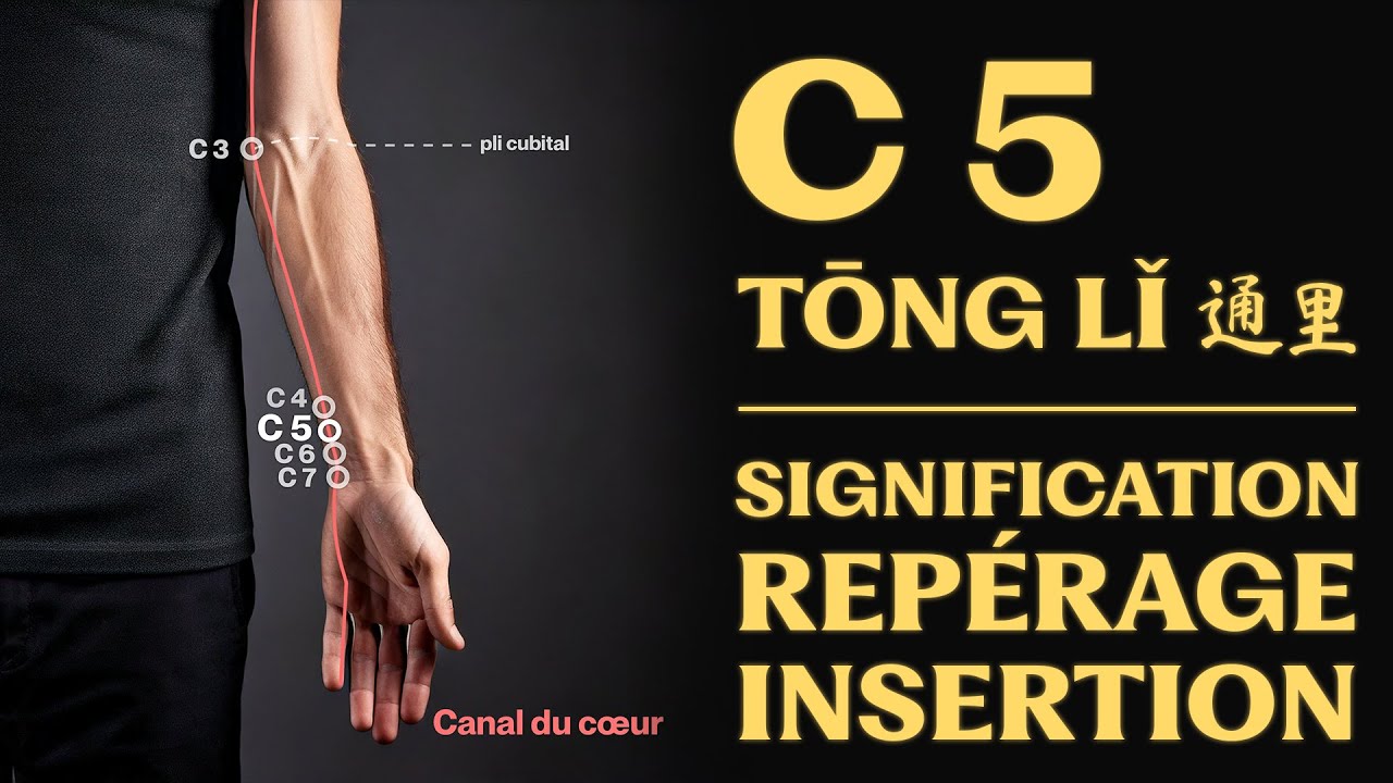 Point d'acupuncture : C 5 (tōng lǐ 通里) signification, repérage, insertion