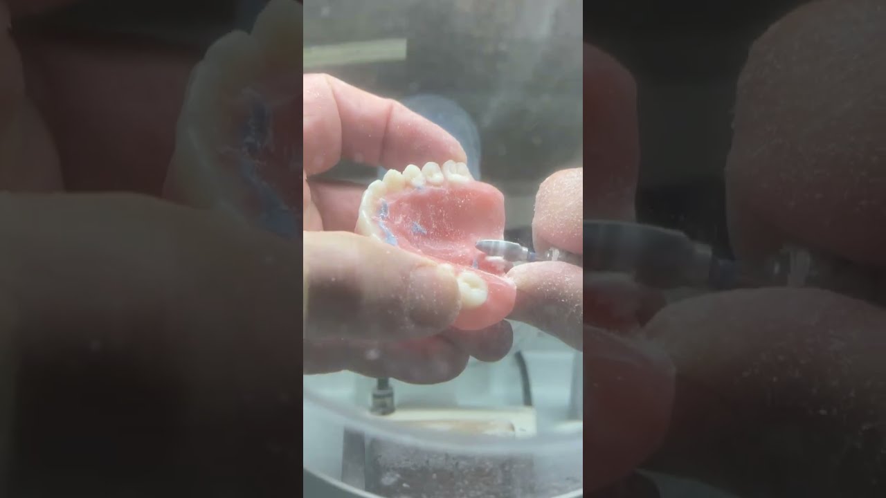 Hand Trimming Your Dentures Part 3
