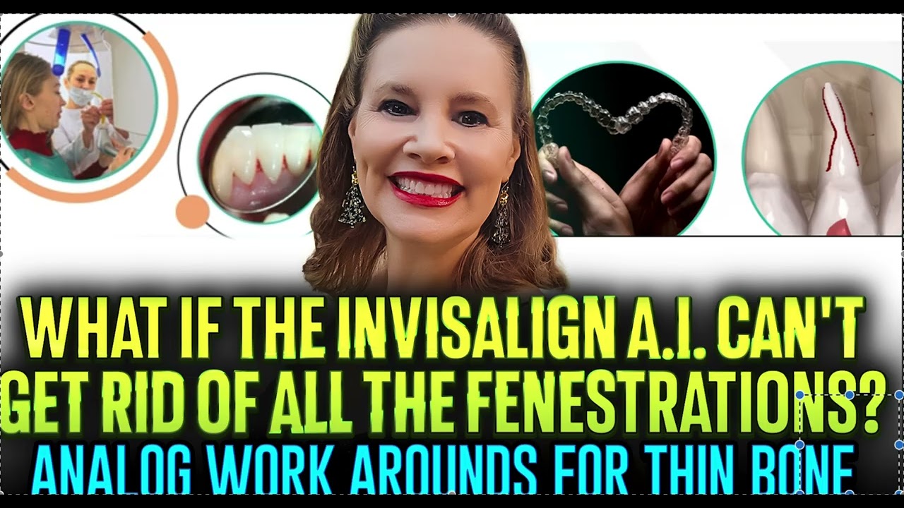 Тонкие кости против системы Invisalign с искусственным интеллектом и фенетацией — использование а...