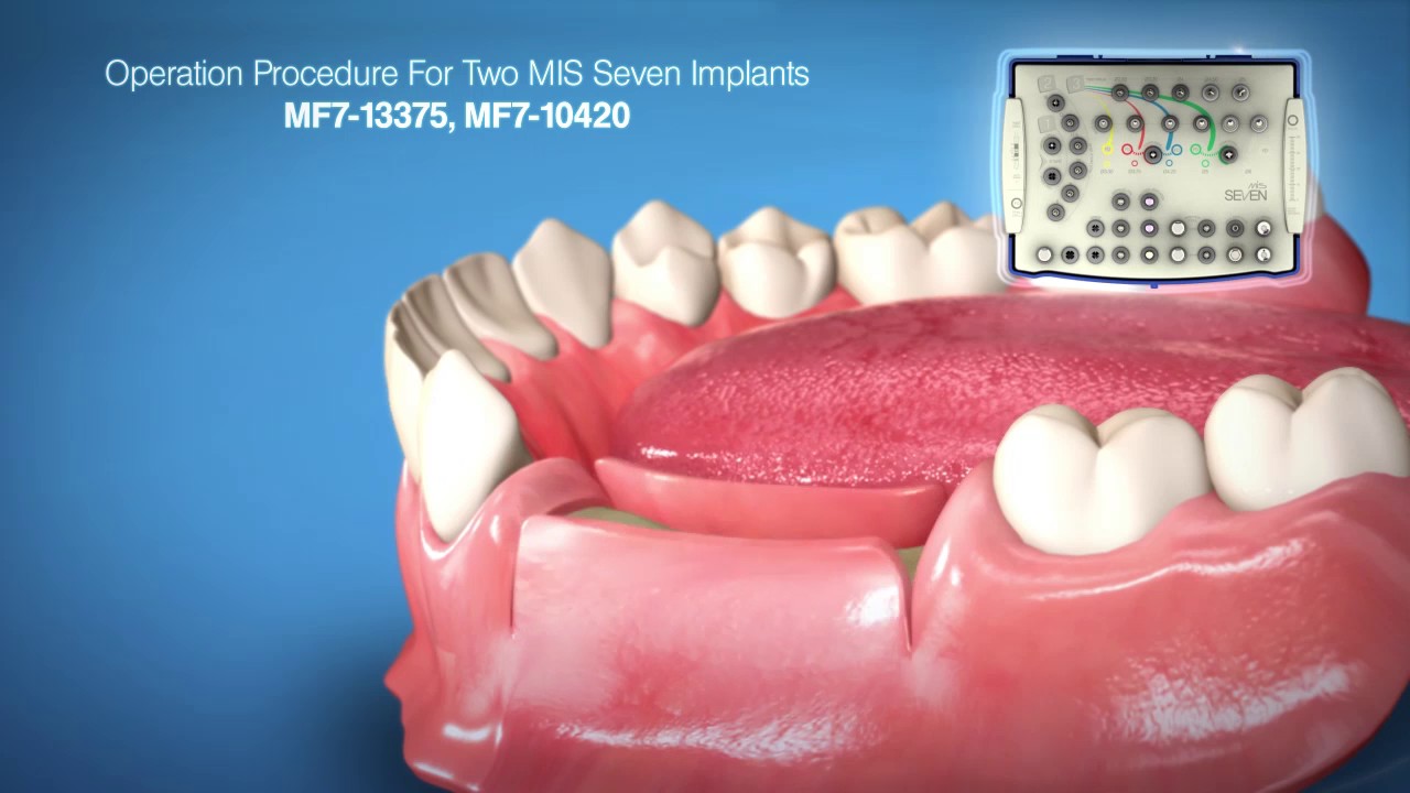 SEVEN Surgical Kit