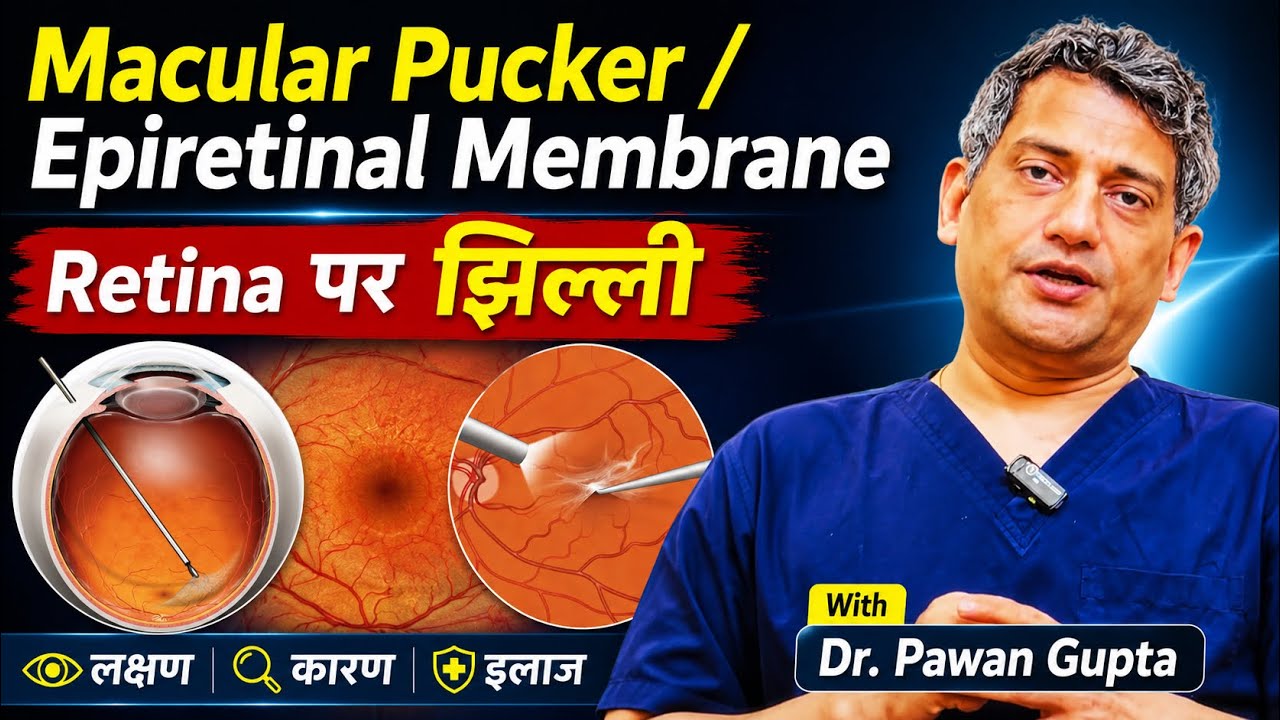 सीधी Lines टेढ़ी और धुंधला टेढ़ा दिख रहा है? Macular Pucker को समझिए | Dr. Pawan Gupta