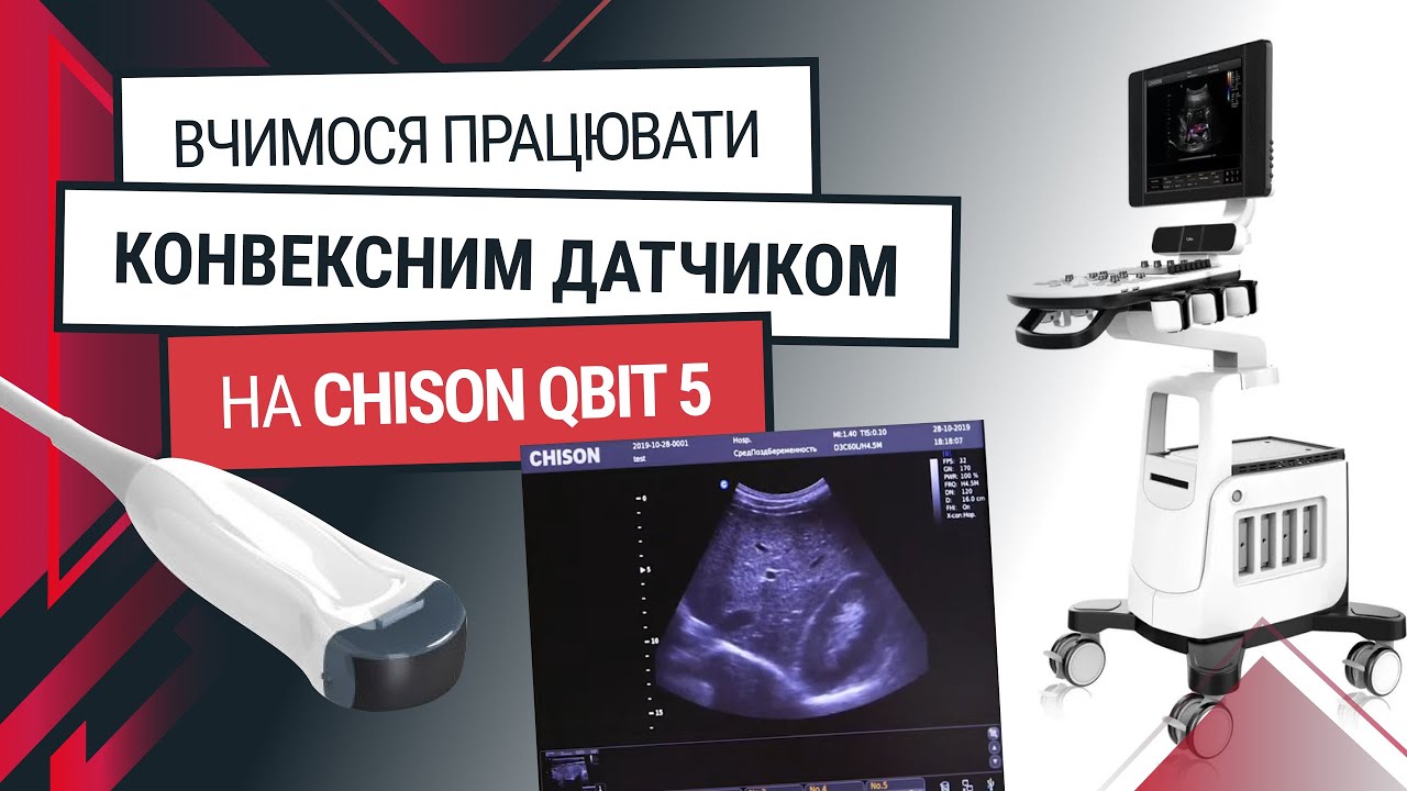 Конвексний датчик до Chison Qbit 5 - навчання та функції
