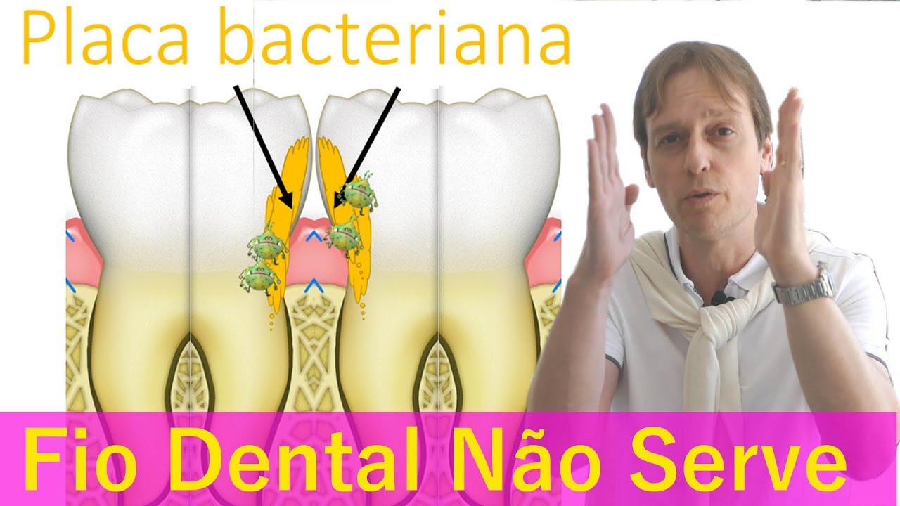 Fio Dental Não Serve Para Limpar Entre Os Dentes