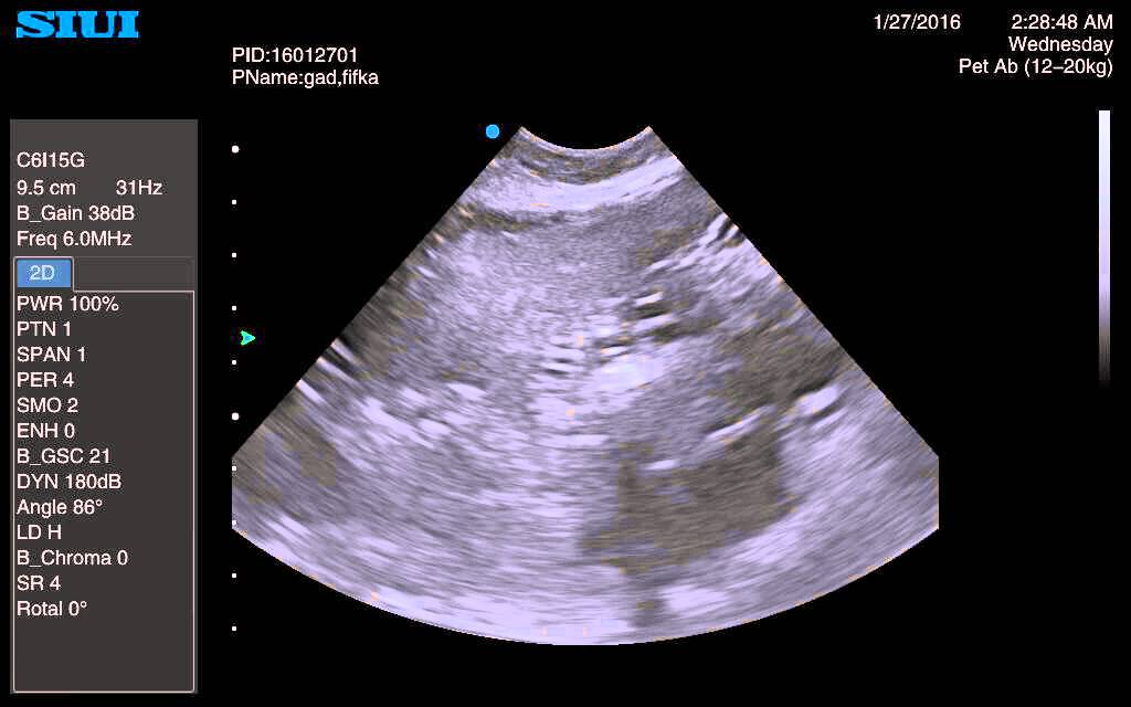 SIUI CTS 8800 V Plus Abdo splenomegalia u psa