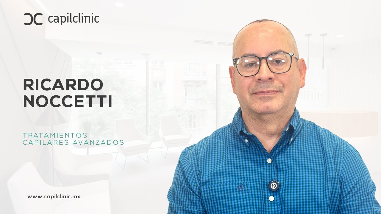 ¿Vale la pena un injerto de cabello en México? Mi experiencia en CapilClinic