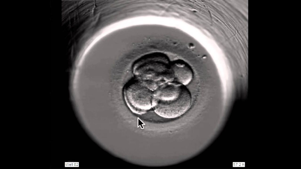 ivf embryo developing over 5 days by fertility Dr Raewyn Teirney