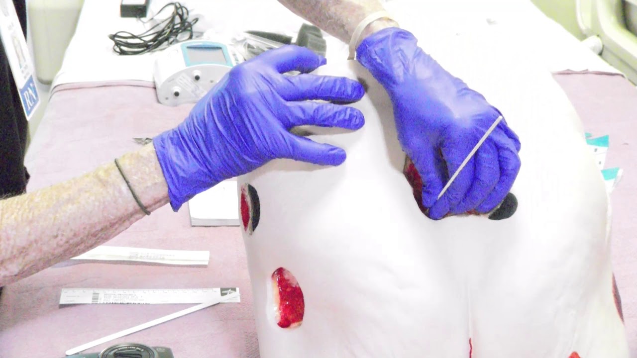 #1 of 2 Wound Measurement and Photographing