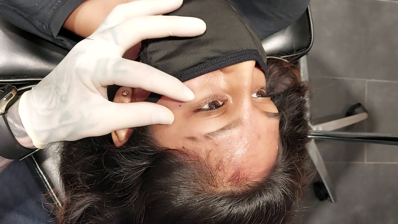 Dermal  piercing   by Jamesthepiercer